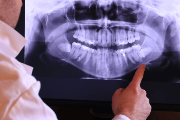 Best Emergency Root Canal Treatment in New London, CT