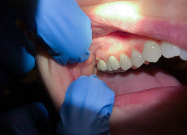 Best Cosmetic Emergency Dentistry in New London, CT