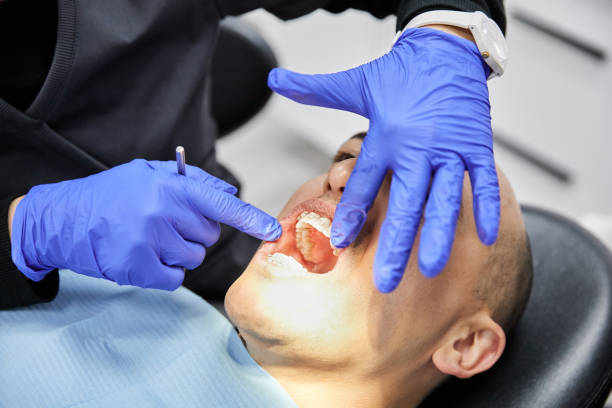 Best Emergency Dental Care for Broken or Chipped Teeth in New London, CT