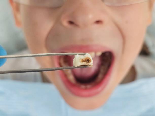  New London, CT Emergency Dentist Pros