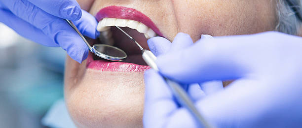Best Same-Day Emergency Dental Services in New London, CT